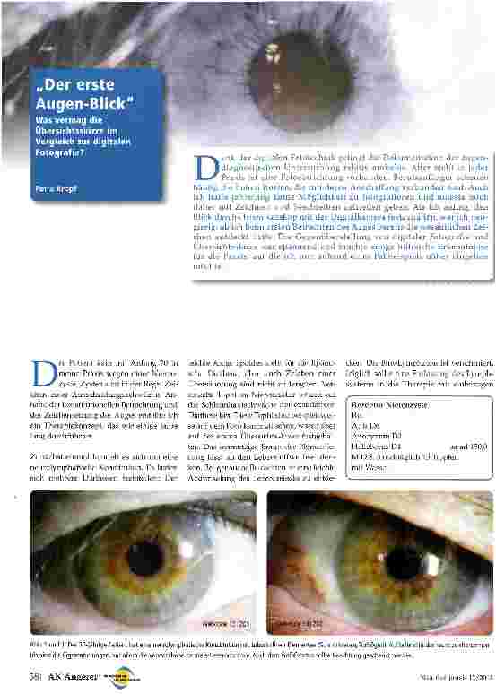 Vorschauseite 1: Der erste Augen-Blick