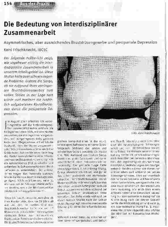 Vorschauseite 1: Die Bedeutung von interdisziplinärer ZusammenarbeitAsymmetrisches, aber ausreichendes Brustdrüsengewebe und postpartale Depression