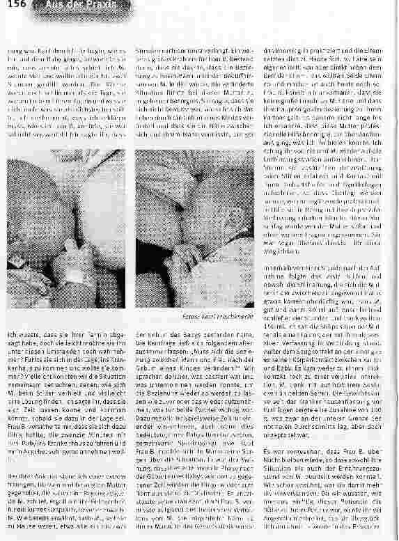 Vorschauseite 3: Die Bedeutung von interdisziplinärer ZusammenarbeitAsymmetrisches, aber ausreichendes Brustdrüsengewebe und postpartale Depression