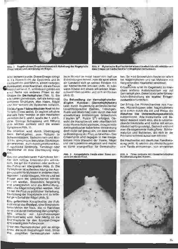 Vorschauseite 2: Arbeitsgebiete der modernen Dermatologie 4. Folge: Pilzerkrankungen der Haut, Schleimhaut u. d. inneren Organe