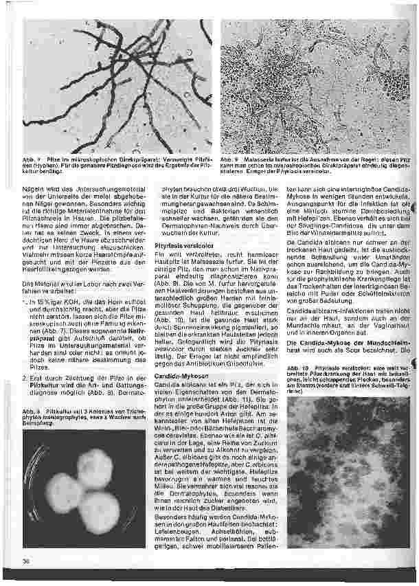 Vorschauseite 3: Arbeitsgebiete der modernen Dermatologie 4. Folge: Pilzerkrankungen der Haut, Schleimhaut u. d. inneren Organe