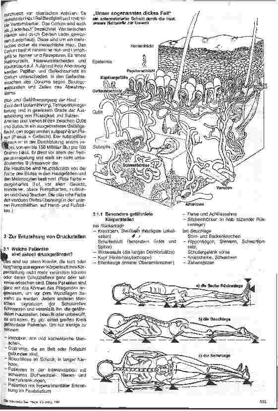 Vorschauseite 2: Druckstellen - Drucknekrosen - Decubituserkrankung, gefährliche Komplikationen beim immobilen Patienten 1. Folge