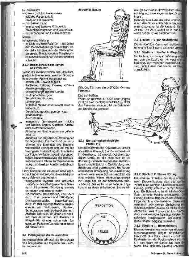 Vorschauseite 3: Druckstellen - Drucknekrosen - Decubituserkrankung, gefährliche Komplikationen beim immobilen Patienten 1. Folge