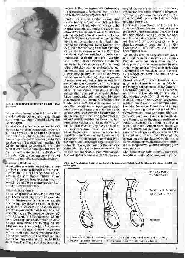 Vorschauseite 2: Kinderheilkunde 40. Folge: Symtomatik u. Therapie der Nabelu. Leistenhernie
