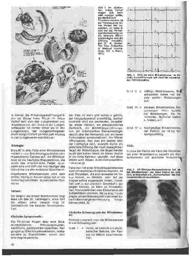Vorschauseite 3: Das Herz 11.Folge: Erworbene Herzfehler, Klinik u. operative Therapie (I.Teil)