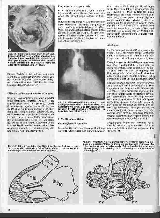 Vorschauseite 6: Das Herz 11.Folge: Erworbene Herzfehler, Klinik u. operative Therapie (I.Teil)