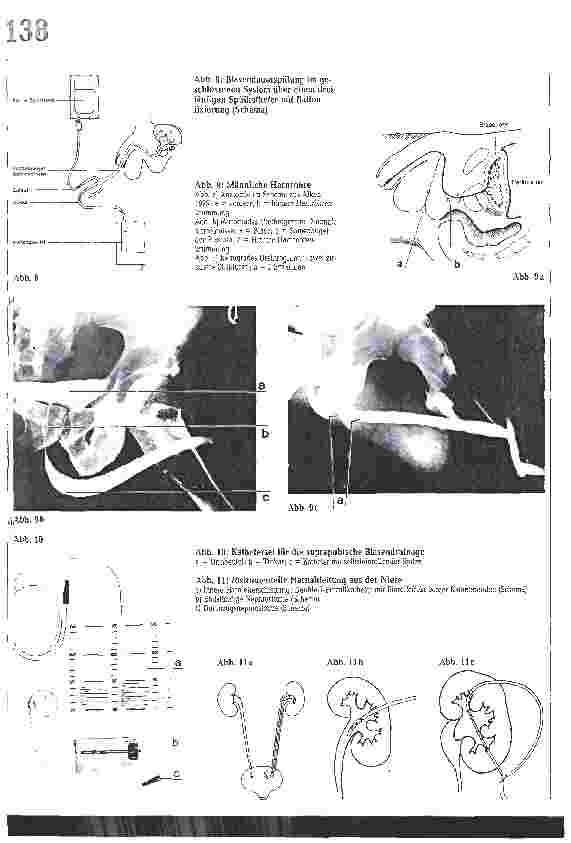 Vorschauseite 6: Instumentelle Harndrainage