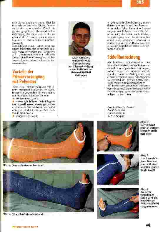 Vorschauseite 2: Primärversorgung mit Polyester bei ausgewählten Frakturformen