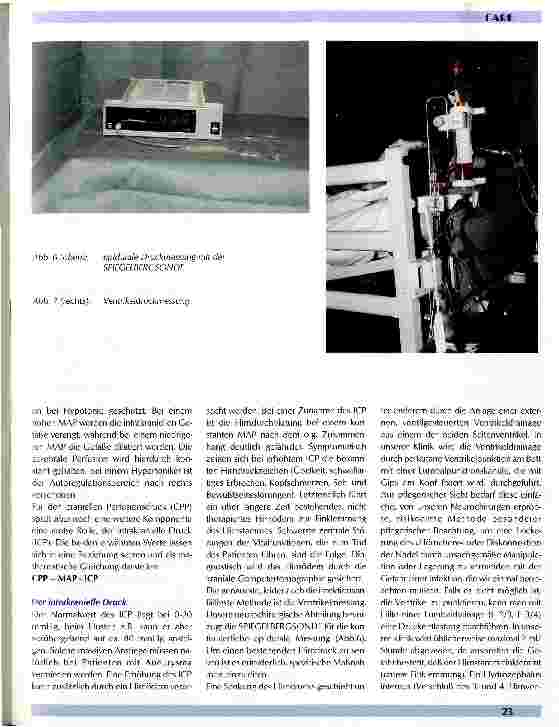 Vorschauseite 4: Patienten mit Hirnarterienaneurysma und ihre Pflege