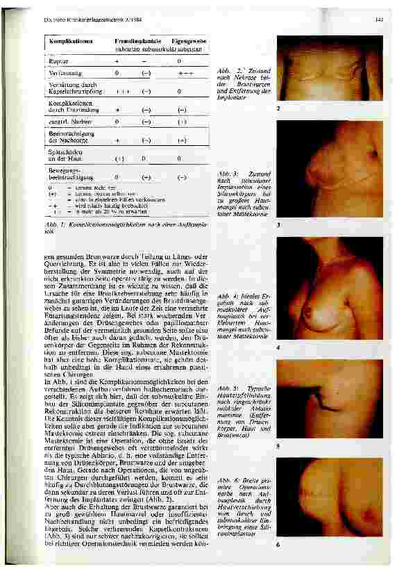 Vorschauseite 2: Die Problematik der Brustamputation und Rekonstruktion in der Tumorchirurgie