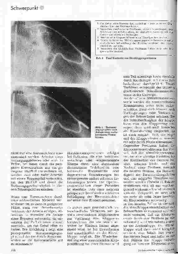 Vorschauseite 3: Herzchirurgie Stand der Herzchirurgie heute