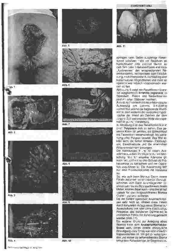 Vorschauseite 2: Das Stroma