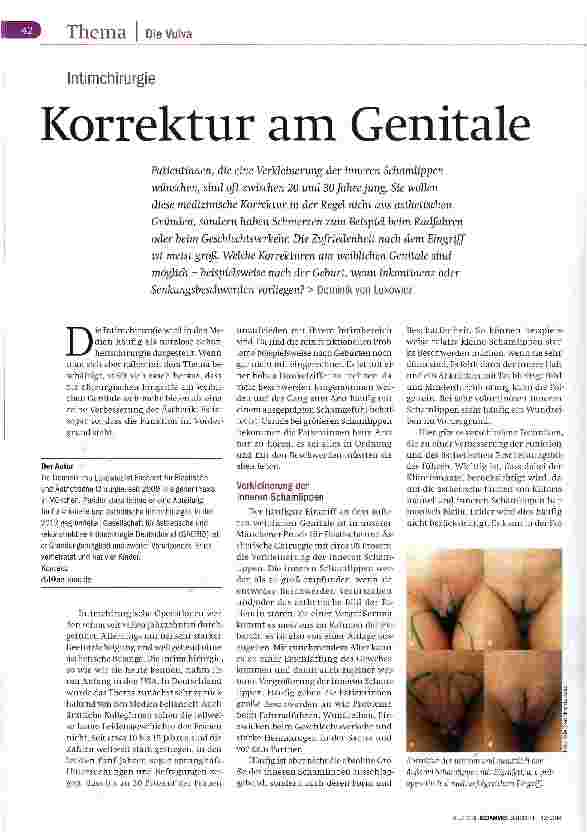 Vorschauseite 1: Korrektur am Genitale