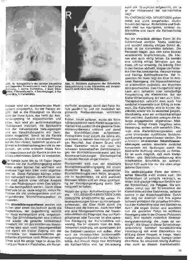 Vorschauseite 3: Einführung in die Hals - Nasen - Ohren - Heilkunde 11. Folge: Die Nase-, Entzündungen der Nasennebenhöhlen
