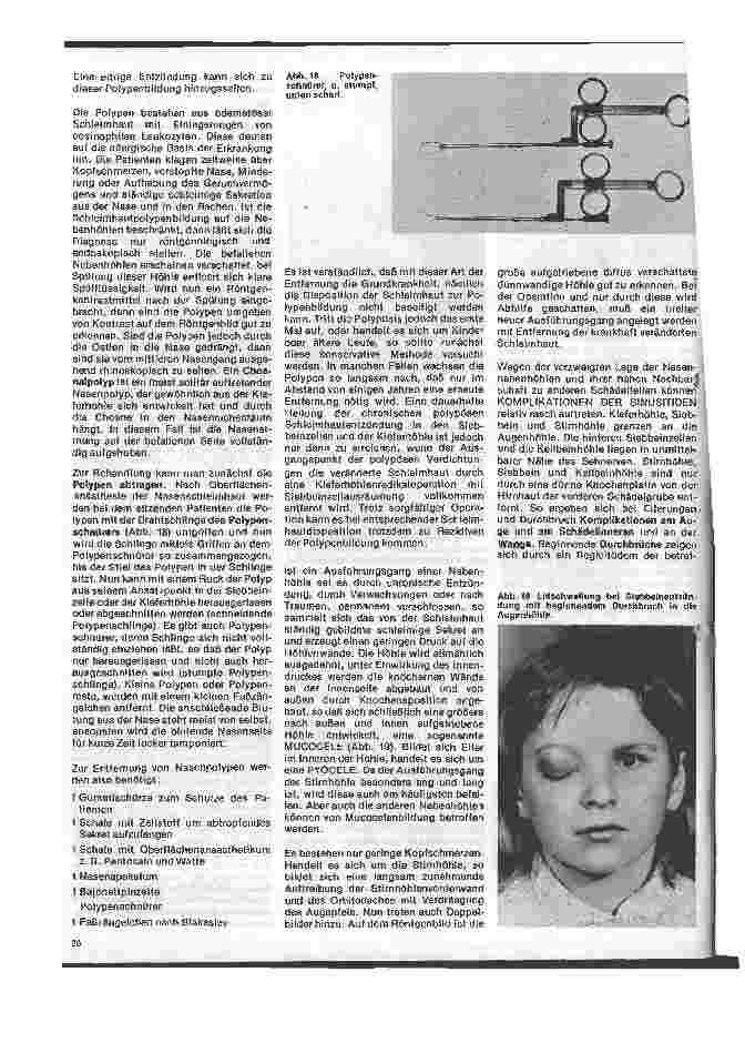 Vorschauseite 4: Einführung in die Hals - Nasen - Ohren - Heilkunde 11. Folge: Die Nase-, Entzündungen der Nasennebenhöhlen