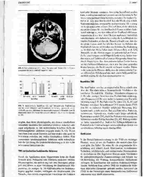 Vorschauseite 4: Bedeutung der TMS für die Rehabilitationsforschung
