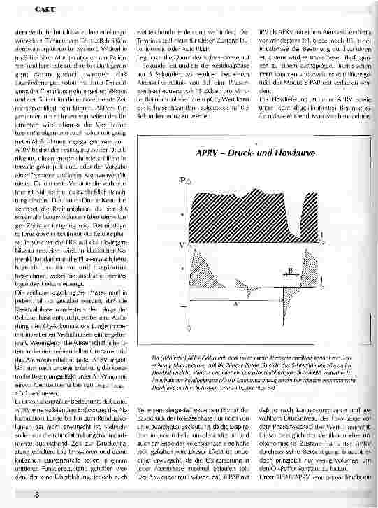 Vorschauseite 4: APRV Airway Pressure Release Ventilation Mentale Ventilation eines Beatmungsmodus