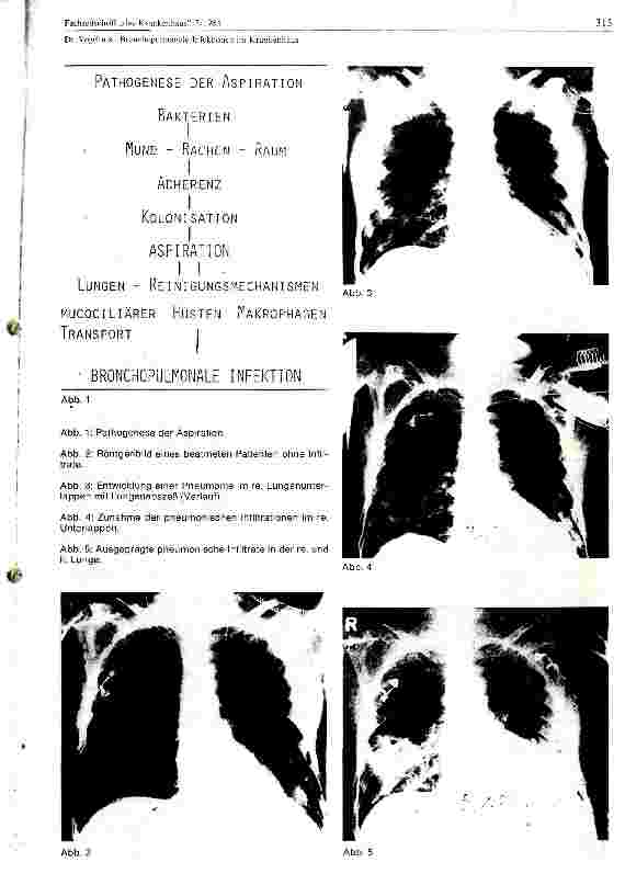 Vorschauseite 5: Bronchopulmonale Infektionen im Krankenhaus