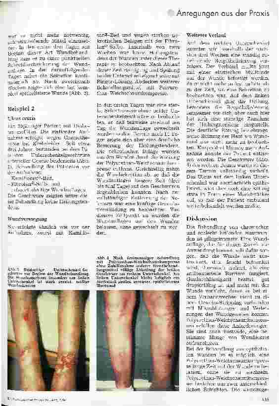 Vorschauseite 2: Behandlung schlecht heilender Hautdefekte