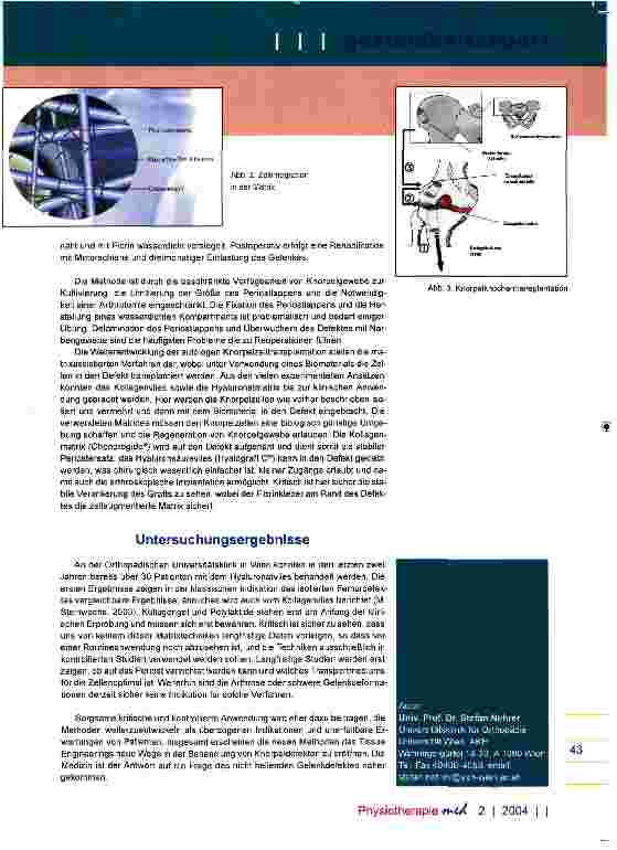 Vorschauseite 3: Präventiver GesundheitssportNeue Konzepte in der Behandlung von Knorpeldefekten Knorpelzelltransplantation