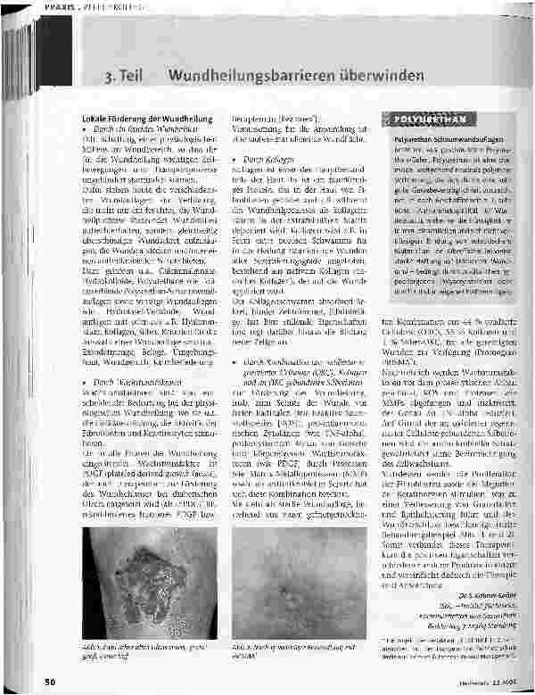 Vorschauseite 3: Wundheilungsfördernde Maßnahmen