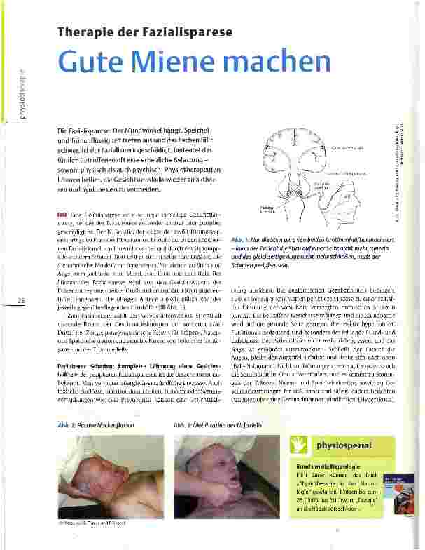 Vorschauseite 1: Therapie der Fazialisparese Gute Miene machen