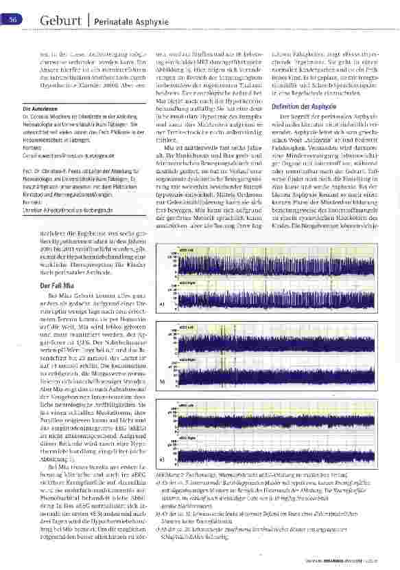 Vorschauseite 2: Perinatale Asphyxie Das Potenzial der Kühlung