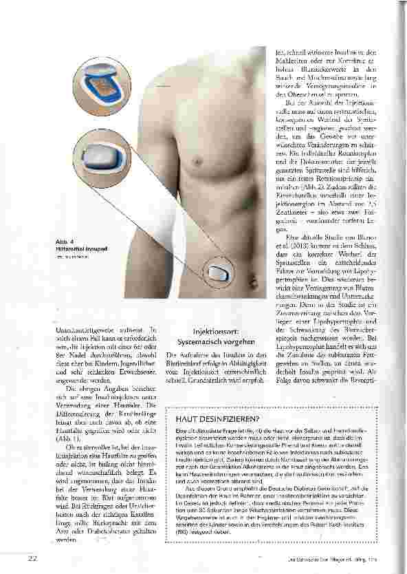 Vorschauseite 3: KORREKTE TECHNIK SICHERT THERAPIE