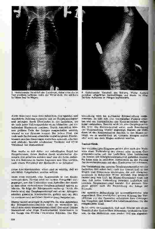 Vorschauseite 2: Angeborene Verschlüsse des Verdauungskanals