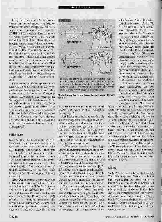 Vorschauseite 2: Prophylaxe chronischer Schmerzen