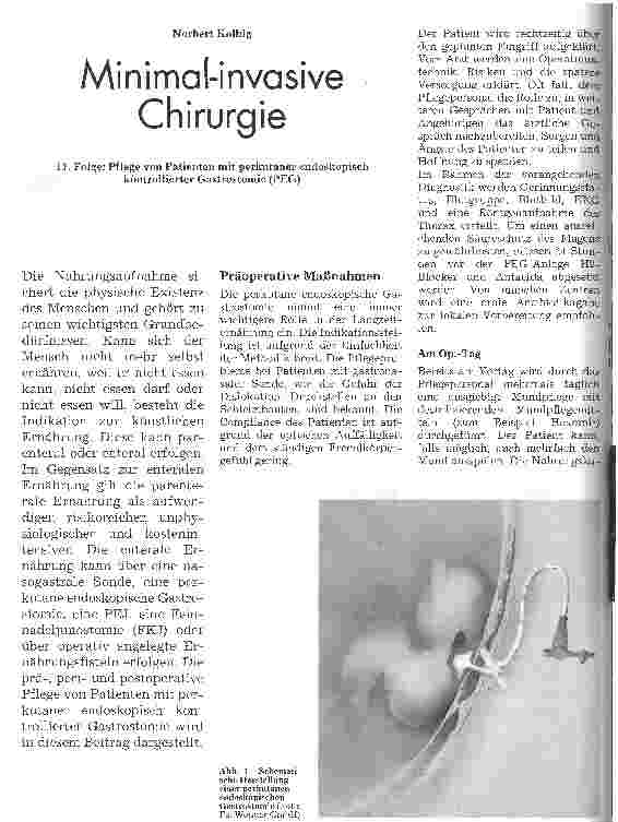 Vorschauseite 1: Minimal-invasive Chirurgie 11. Folge: Pflege von Patienten mit perkutaner endoskopisch kontrollierter Gastrostomie (PEG)