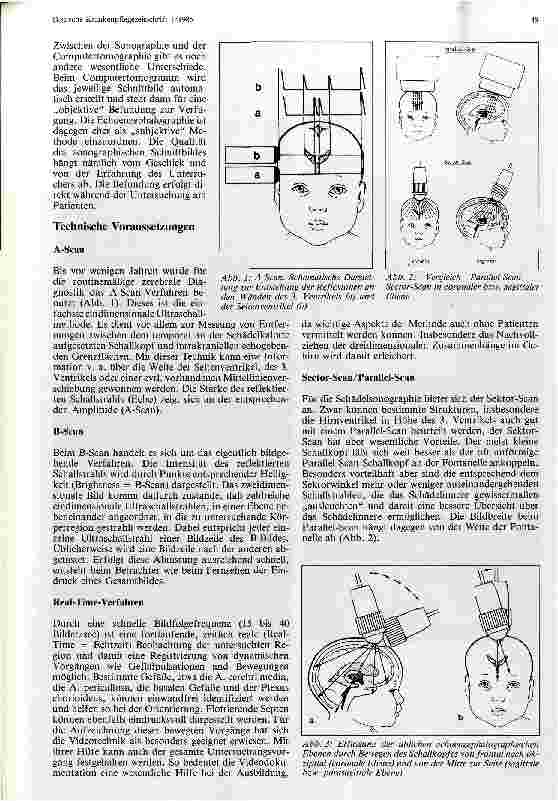 Vorschauseite 2: Echoenzephalographie beim Neugeborenen und Säugling