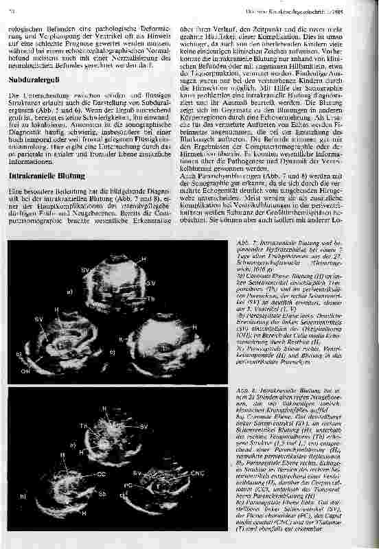 Vorschauseite 5: Echoenzephalographie beim Neugeborenen und Säugling