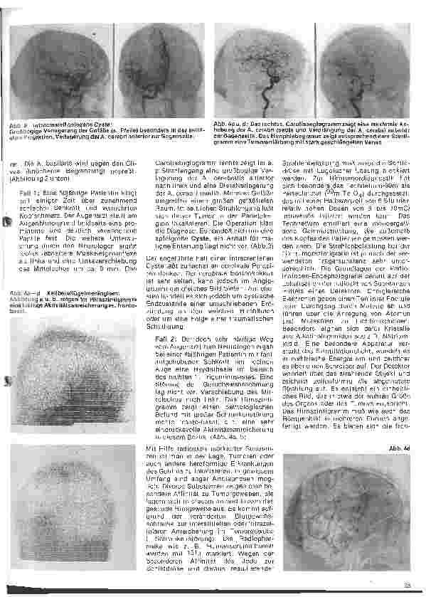 Vorschauseite 2: Radiologie 21.Folge:Neuroradiologie