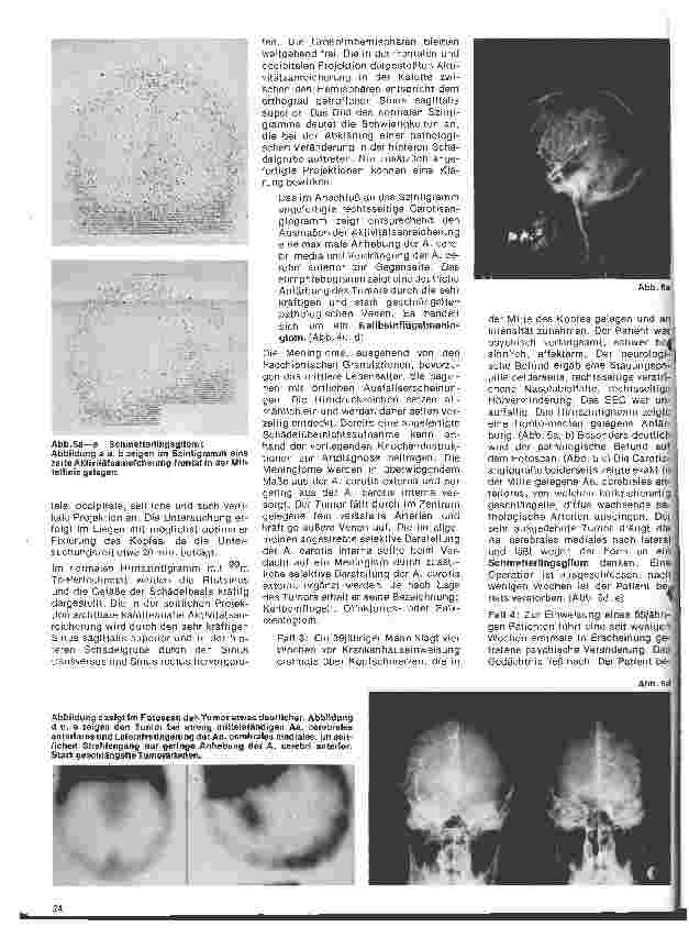 Vorschauseite 3: Radiologie 21.Folge:Neuroradiologie
