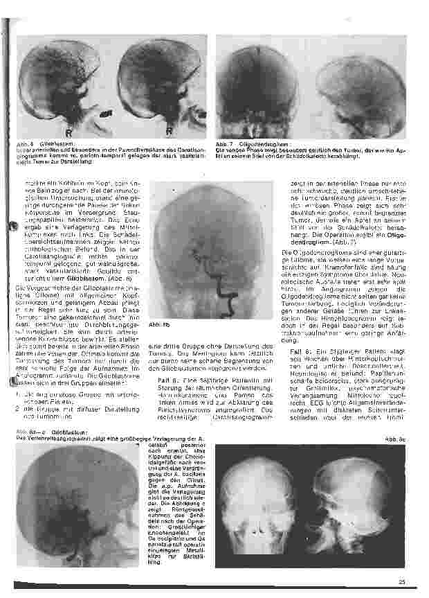 Vorschauseite 4: Radiologie 21.Folge:Neuroradiologie