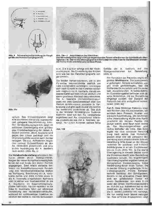 Vorschauseite 5: Radiologie 21.Folge:Neuroradiologie