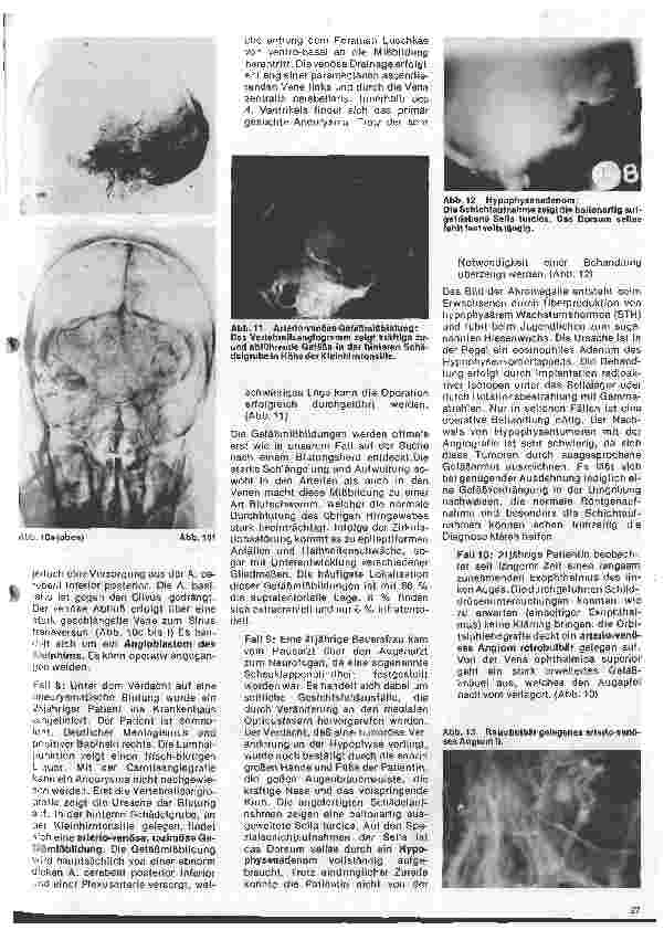 Vorschauseite 6: Radiologie 21.Folge:Neuroradiologie