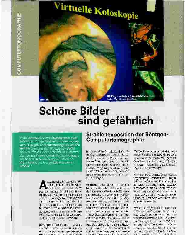 Vorschauseite 1: Schöne Bilder sind gefährlichStrahlenexposition der Röntgen Computertomographie