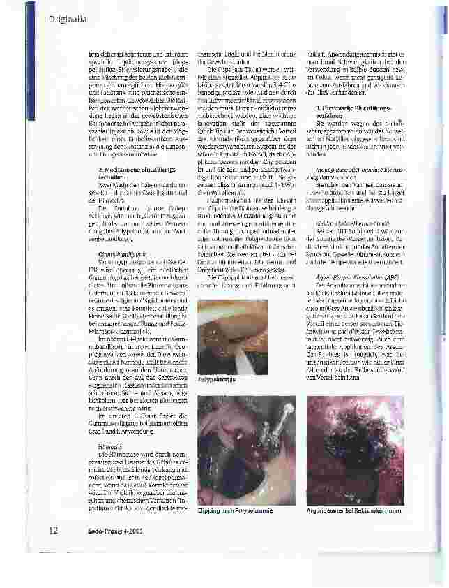 Vorschauseite 4: Notfallendoskopie bei akuter Blutung im Gastrointestinaltrakt - eine pflegerische Herausforderung