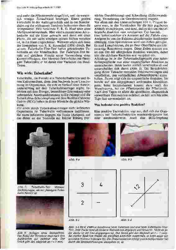 Vorschauseite 3: Tuberkulindiagnostik