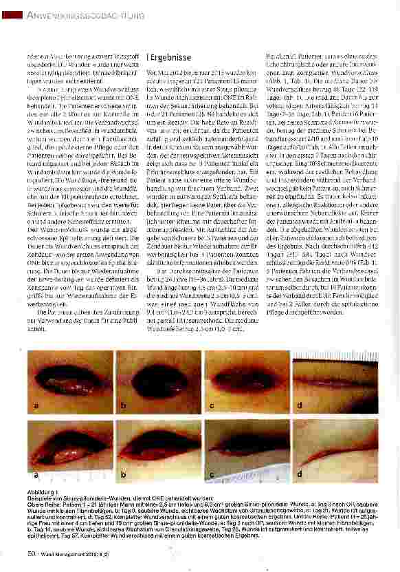 Vorschauseite 3: Pilonidal Sinus Wunden: Sekundäre Wundbehandlung nach chirurgischer Exzision mit einem pflanzlichen Wundtherapeutikum