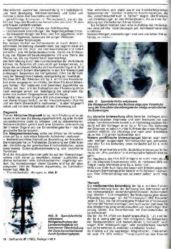 Vorschauseite 4: Die entzündliche-rheumatischen Erkrankungen