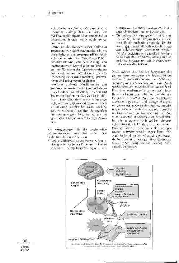 Vorschauseite 3: MULTIMODALE PRÄVENTIVE ANALGESIE -VISION ODER STANDARD?