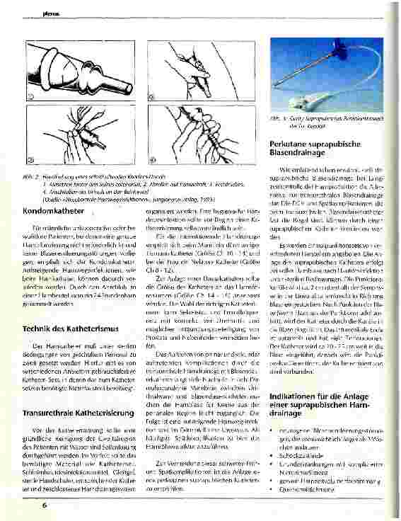Vorschauseite 2: Umgang mit Harndrainagen