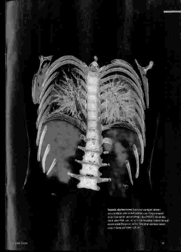 Vorschauseite 2: Molecular Imaging: Licht im Dunkeln