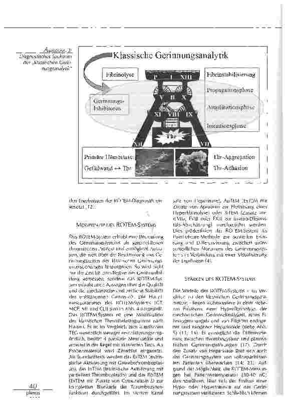 Vorschauseite 3: MANAGEMENT BEI INTRAOPERATIVEN BLUTUNGEN
