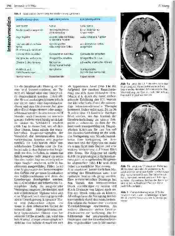 Vorschauseite 2: Klinik und Therapie großer Hemisphäreninfarkte