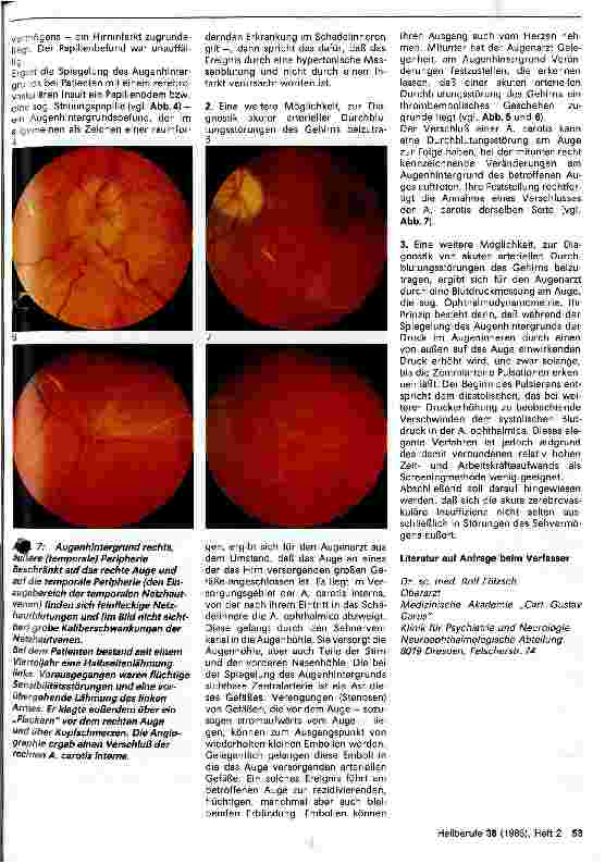 Vorschauseite 2: Augensymptome bei akuten arteriellen Durchblutungsstörungen des Gehirns