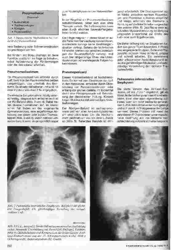 Vorschauseite 3: Intensivmedizinisches und pflegerisches Management beim Air-Leak-Syndrom